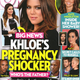 Image for article titled This Week in Tabloids: A Dubious and Fucked-Up Guide to Celebrity Eating Disorders